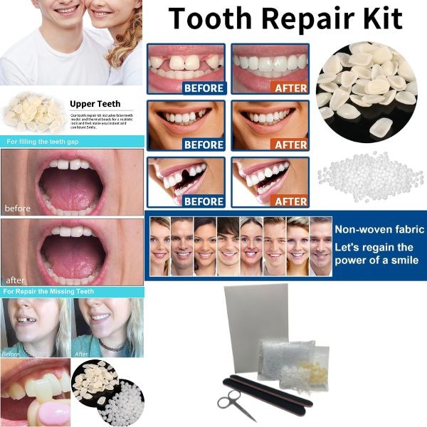 Tooth Repair Kit - Full Repair Kits - 12 Kits For $30.00